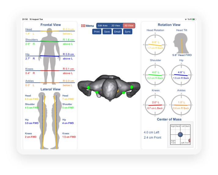 3D Posture Analysis