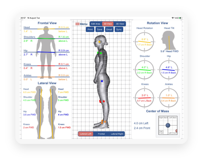 Lateral (left-right) Posture Analysis